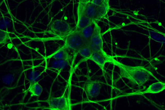 Úc giới thiệu loại gel từ tế bào gốc giúp điều trị tổn thương não bộ - Ảnh 1.