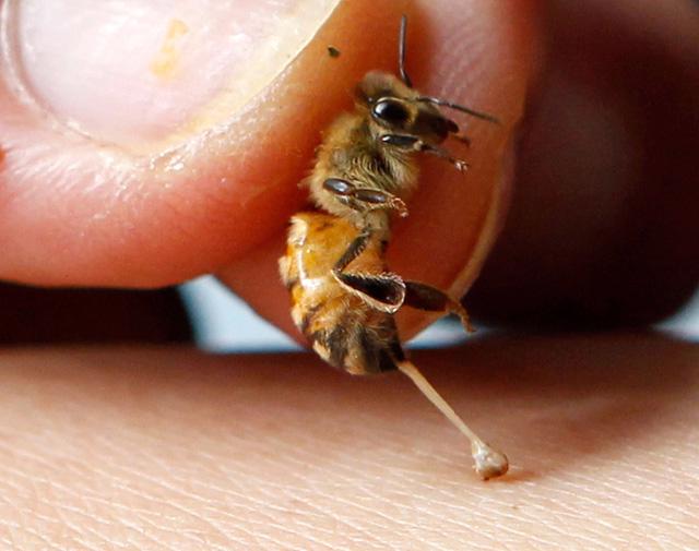 Thực hư việc dùng nọc ong chữa viêm khớp - Ảnh 1.