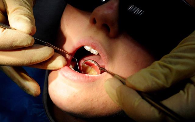 Ung thư đường tiêu hóa có liên quan tới sức khỏe răng miệng - Ảnh 1.