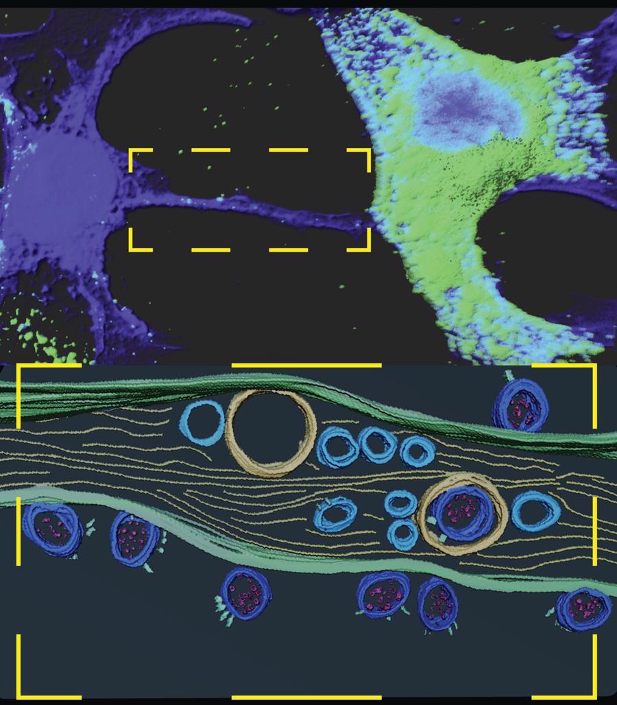 H&igrave;nh ảnh hiển vi huỳnh quang (tr&ecirc;n) v&agrave; điện tử lạnh (dưới) cho thấy SARS-CoV-2 b&ecirc;n trong v&agrave; tr&ecirc;n đỉnh của c&aacute;c ống nano đường hầm.