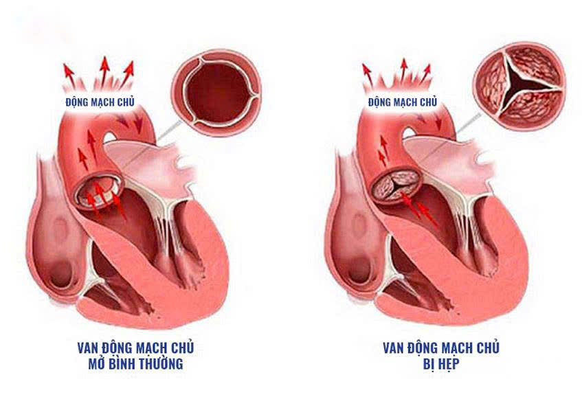 Nâng tầm chất lượng điều trị tim mạch theo chuẩn quốc tế - Ảnh 1